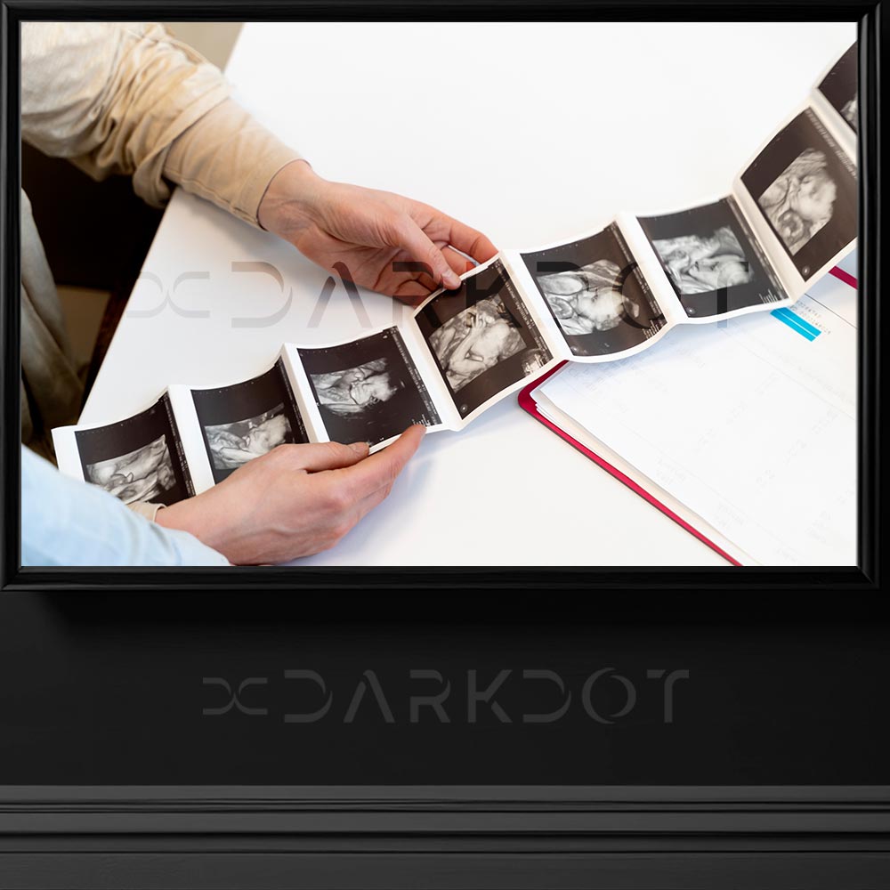 anne karninda bebek fotografi elinde dogacak bebegin fotografini tutan doktor