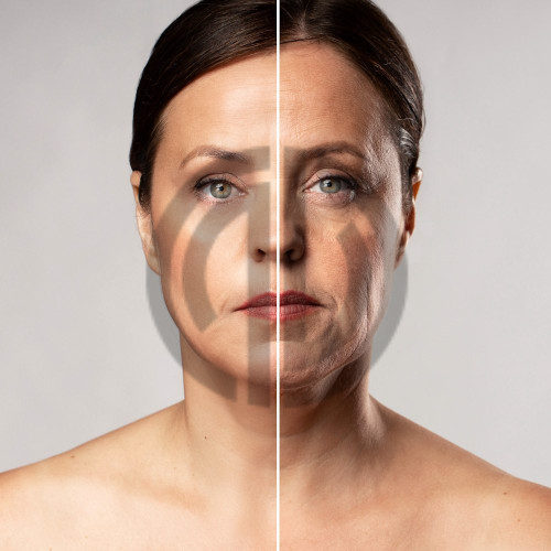 3450 yaşlı kadın yüz estetiği fotoğrafı yüz gerdirme ameliyatı öncesi ve sonrası görsel